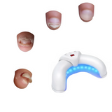 Appareil UV ongle pied mycose soin maison